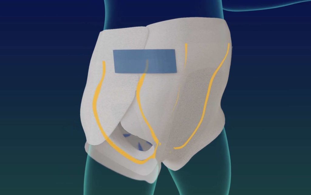 3D Animated Demo of Nappy on Baby